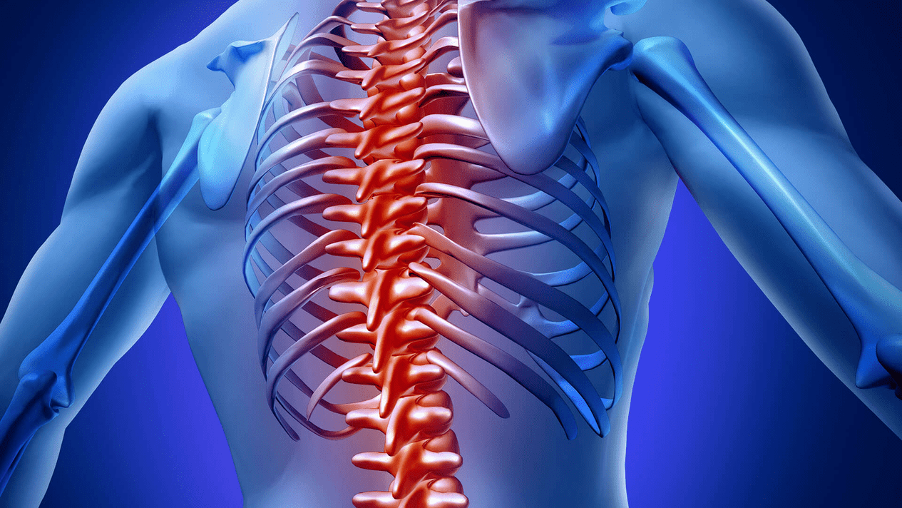 osteocondrosis de la columna torácica