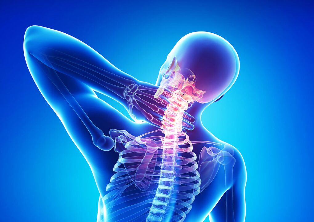 Dolor en el cuello