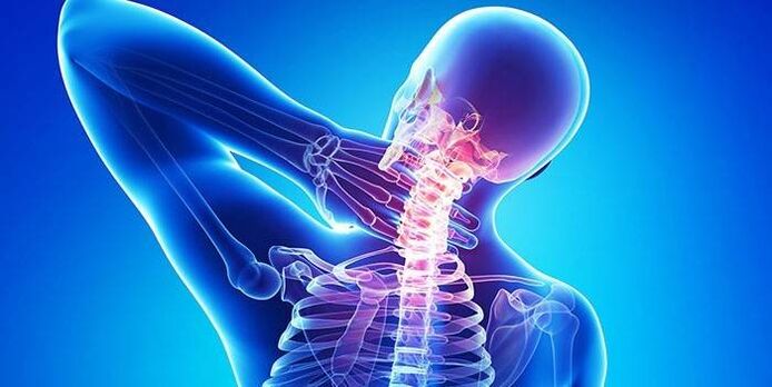 Las causas de la osteocondrosis