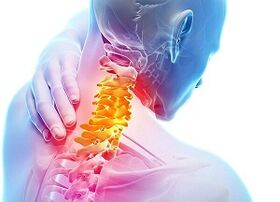 Causas de osteocondrosis cervical