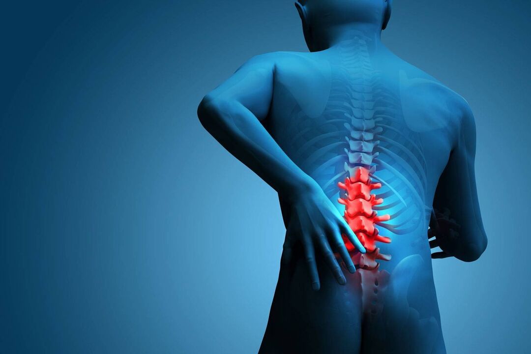 dolor con osteocondrosis lumbar